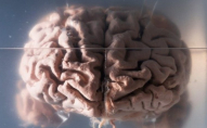 Вперше у світі у мозку 64-річної жінки знайшли хробака. ФОТО