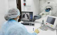 Як українцю зробити безкоштовну комп'ютерну томографію грудної клітини, - МОЗ