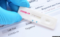 У Луцькому районі виявили 280 нових випадків коронавірусу