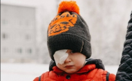 Дворічний волинянин може втратити око через нещасний випадок: сім'я просить про допомогу