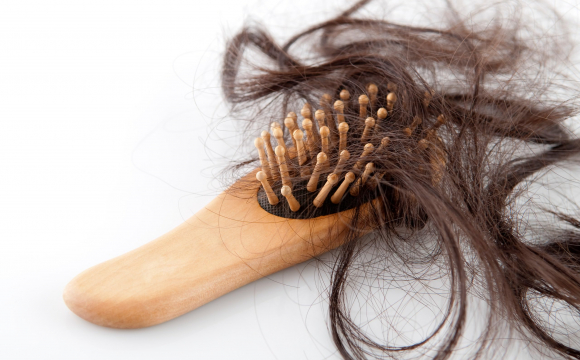 Після безсимптомного коронавірусу у жінки клаптями почало випадати волосся . ФОТО 