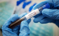 Через новий штам коронавірусу може бути нова хвиля пандемії