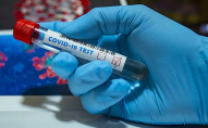 Чотири летальні випадки: на Волині зростає кількість хворих на коронавірус