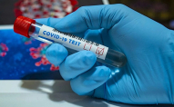 За добу на Волині 530 нових випадків коронавірусу