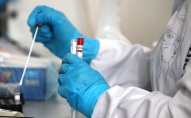 Не лише пацієнти з підозрою на коронавірус: хто може безкоштовно зробити ПЛР-тест