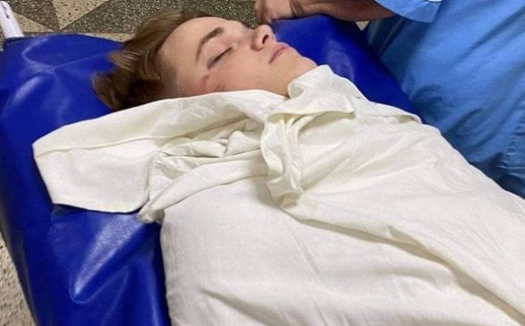 Крововилив у мозок і кома: працівник УДО жорстоко побив танцівника Дорофєєвої