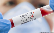 У Чехії виявили перших інфікованих «бразильським» штамом коронавірусу