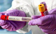 25 смертей за добу: статистика коронавірусу на Волині