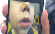Мама дитини, якій заклеювали рот скотчем у дитсадку, відмовилась давати свідчення в поліції
