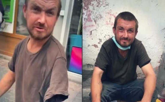 «Спалився» : у львівського жебрака магічним способом виросла рука. ВІДЕО