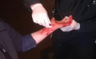 28-річний волинянин порізав вени біля поліцейського відділку