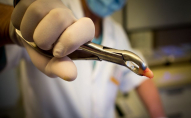 У Київській області стоматологи видалили дитині 12 молочних зубів одночасно без згоди матері