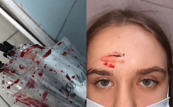У торговому центрі агресивна жінка до крові побила дівчину. ФОТО
