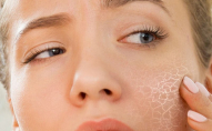 Суха шкіра: як покращити її стан - поради експертів