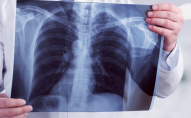«Насос, який викачує бабло»: у луцькій лікарні скаржаться на платний рентген для хворих на коронавірус
