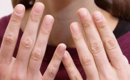 Як відновити нігті після гель-лаку
